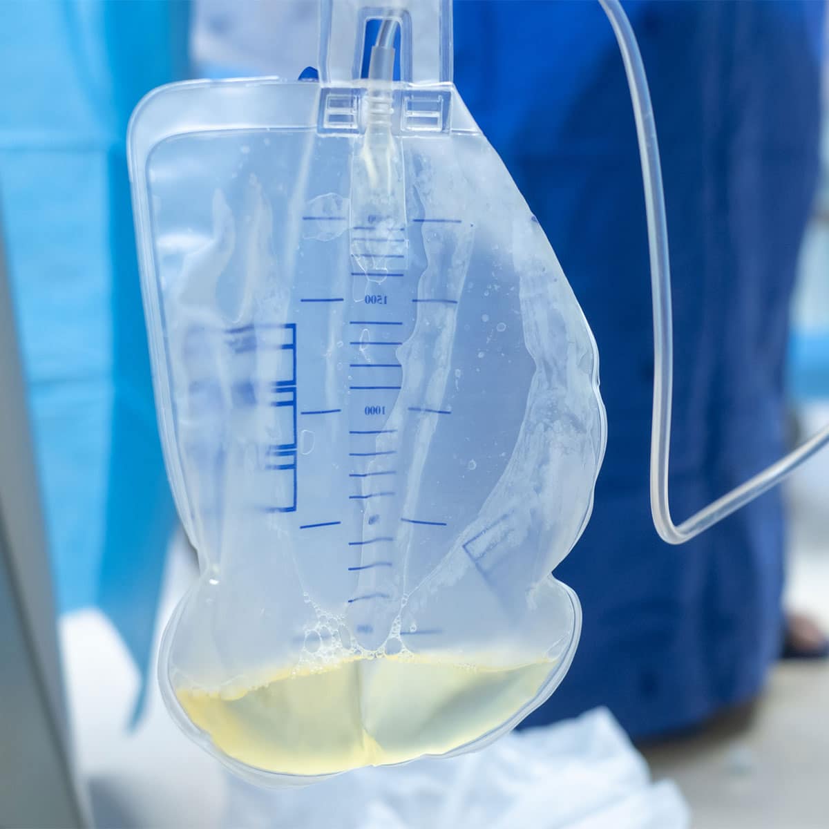 Pose et entretien de sondes urinaires